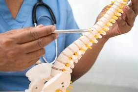 Dar Kanal (Lomber Spinal Stenoz) Nedir?