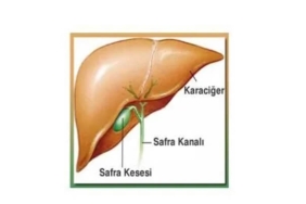 Safra Kesesi Ameliyatı