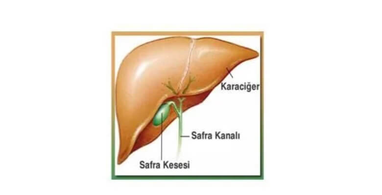 Safra Kesesi Ameliyatı
